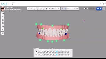 uDesign Cloud - Showing Treatment Plan to Patient
