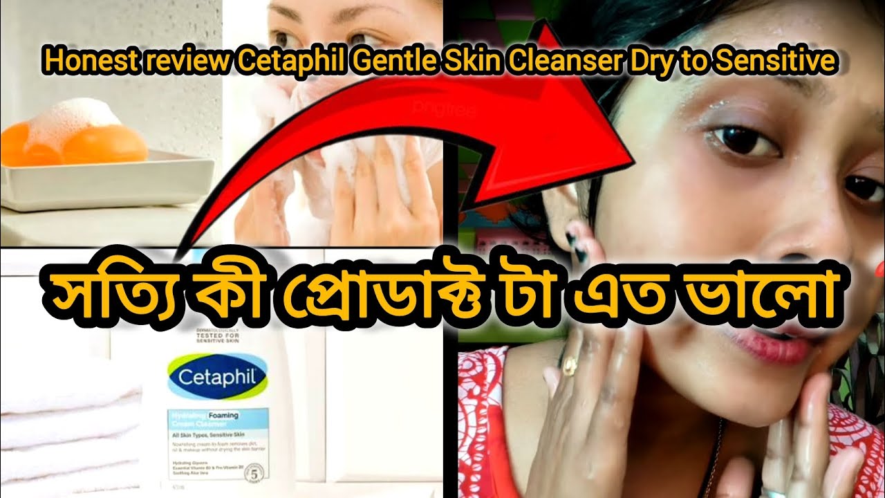 winter season best Cetaphil Gentle Skin Cleanser Dry to Sensitive skin||(ক্লিনজার টি কেমন)