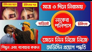 নাকের পলিপাস দূর করার উপায় । মেডিসিন ব্যবহারের পদ্ধতি । NAKER POLIPAS |