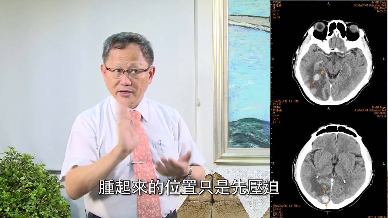 肺癌 當肺癌轉移時 Youtube 肺癌 當肺癌轉移時 Youtube