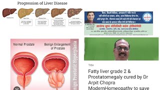 Fatty liver grade 2 & BPH Prostatomegaly cured by Dr ArpitChopra ModernHomeopathy saved complication