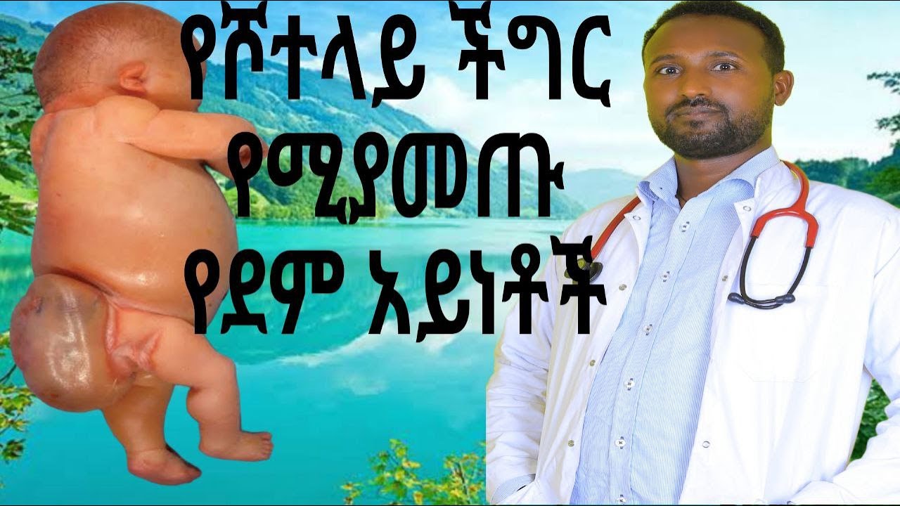 ሾተላይ  RH Isoimmunization
