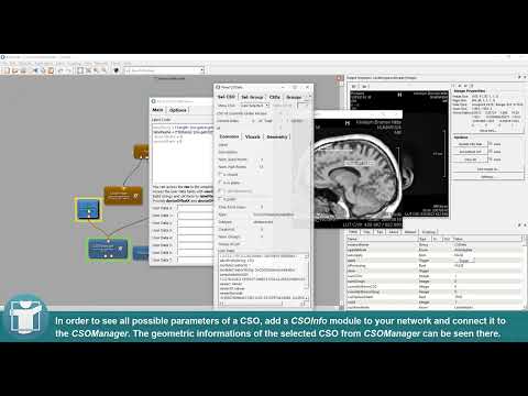 MeVisLab Tutorials - Contours - Create Labels on Contours