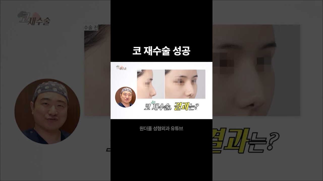 Гайхамшигтай Гоо сайхны Мэс Заслын Эмнэлэг: Хамрын Давтан Мэс Засал Амжилттай