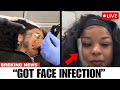 Chrisean Rock Breaks Down While Removing Blueface Tattoo – Emotional Moment Caught on Camera