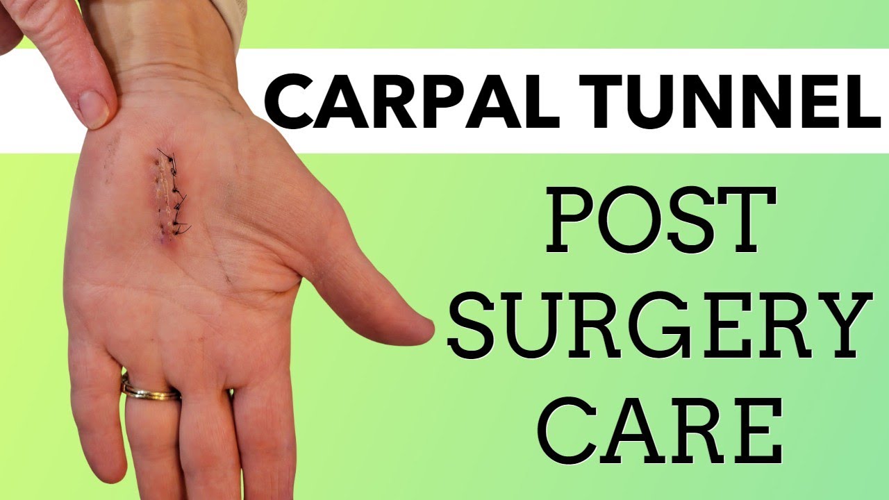 After Carpal Tunnel Surgery Exercises  