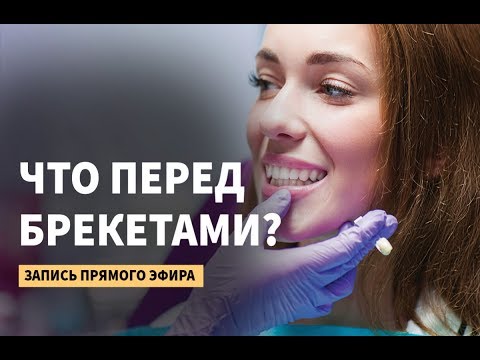 Что надо делать перед установкой брекетов?