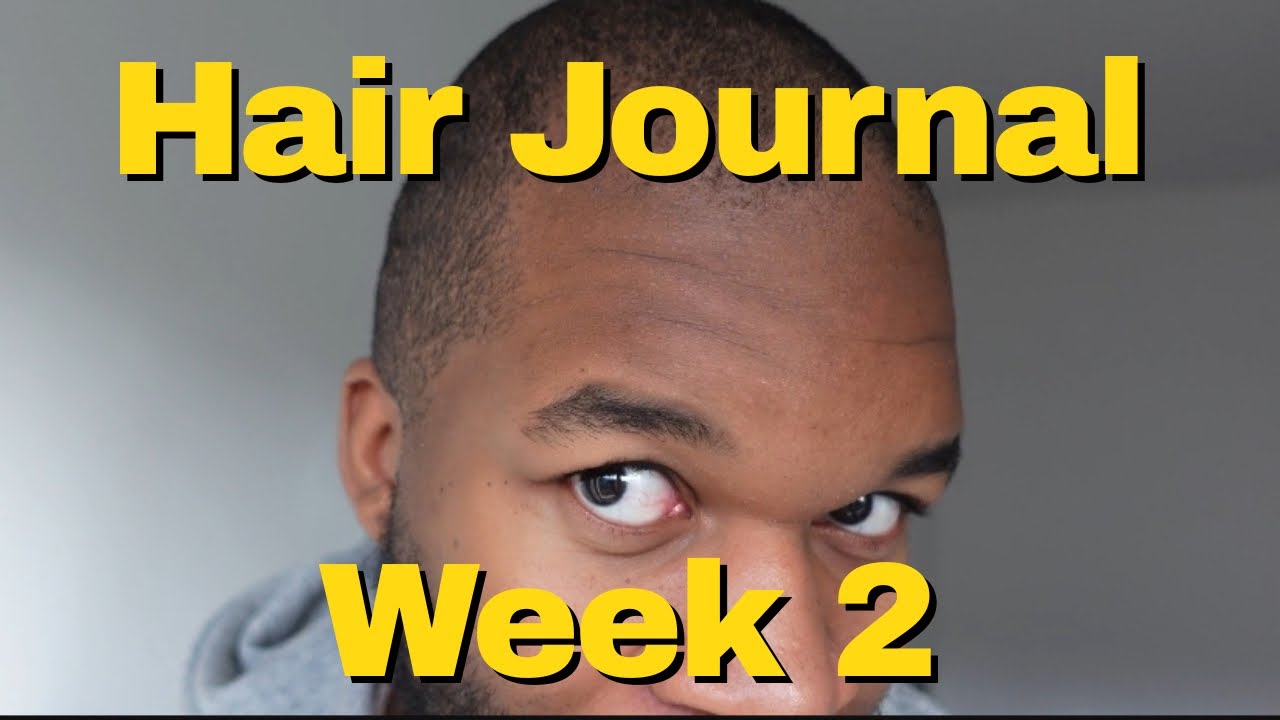 Hair Journal | Week 2| Hairline, Skalp health, Omega 3 fish Oil