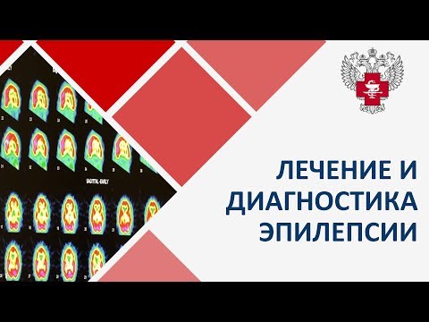 Эпилепсия диагностика лечение. 🧠 Современные методы диагностики и лечения эпилепсии.