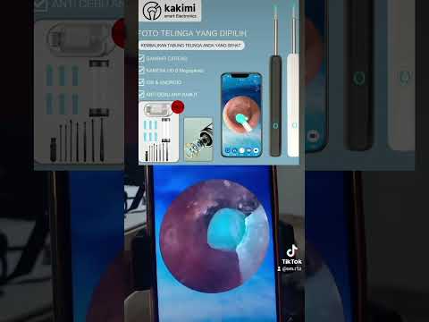 Earwax ( Kotoran telinga) Part 1