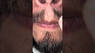barba | Dia 65 de 365 #cryptomonedas #beard #barba #minoxidil