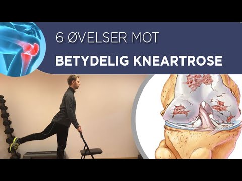 Video: Topp 6 Behandlinger For Artrose I Kneet