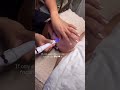 Blackhead Extraction Made Easy with Hydro Probe Technology!