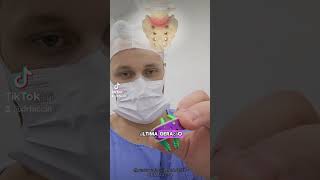 Cirurgia da coluna vertebral pela barriga (Artrodese via anterior - ALIF) - conheça essa técnica!