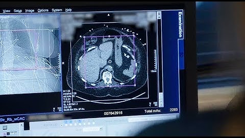 Behind BCVI: The Critical Role of Multi-modality Imaging