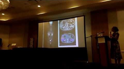 Sarcoma Exchange 2019 - Day 2, Part 2