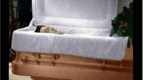 Qual è la causa della morte di Elvis Presley?