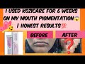 Reviews said this DOESN'T work...🥲 My 6 Week Pigmentation Journey👍