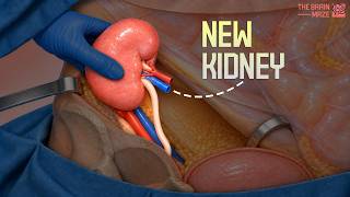 The Insane Process of a Kidney Transplant
