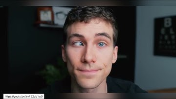 OCULAR MUSCLES | Muscles of the Eye | Eye Movements | Eye Muscles