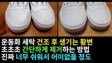 세탁 후 생기는 누런 황변 완전 쉽게 제거하기 너무 쉬워서 어이없음 / 운동화 세탁 신발 세탁 황변제거 방법