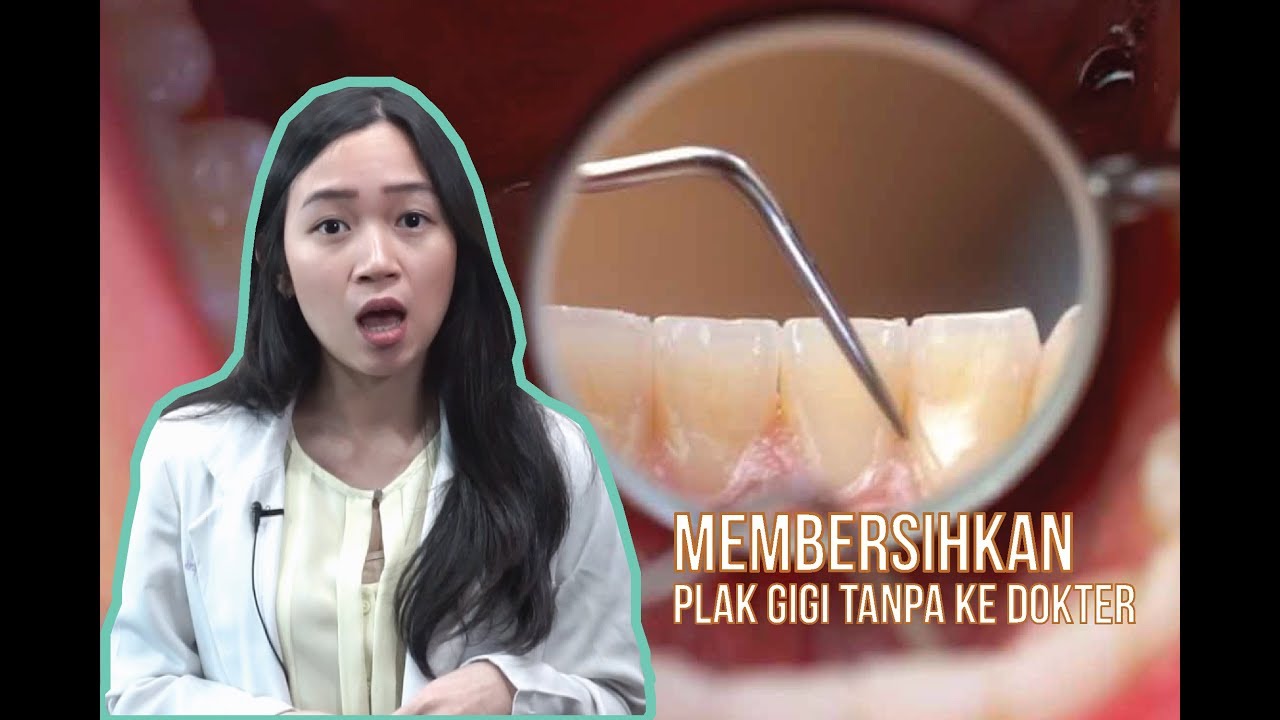 CARA MENGATASI KARANG GIGI TANPA KE DOKTER 
