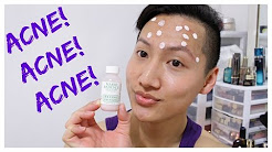 TREATING CYSTIC ACNE with Mario Badescu