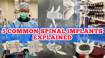 𝟱 𝗦𝗽𝗶𝗻𝗲 𝗦𝘂𝗿𝗴𝗲𝗿𝘆 𝗜𝗺𝗽𝗹𝗮𝗻𝘁𝘀 𝐄𝐱𝐩𝐥𝐚𝐢𝐧𝐞𝐝 𝐄𝐚𝐬𝐢𝐥𝐲 📚😇