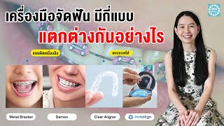 เครื่องมือจัดฟัน มีกี่แบบ แตกต่างกันอย่างไร  | By หมอหนิง