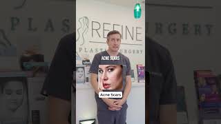 Can A Chemical Peel Fix THIS?! | Dr. Matt Brown.