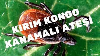 KIRIM KONGO KANAMALI ATEŞİ