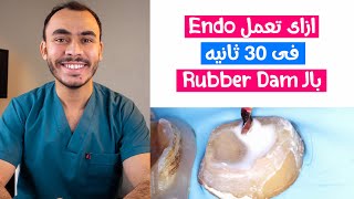 Endodontic Rubber Dam in 30 Sec