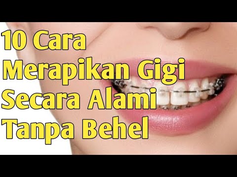 Video: 5 Cara Memperbaiki Gigi Bengkok