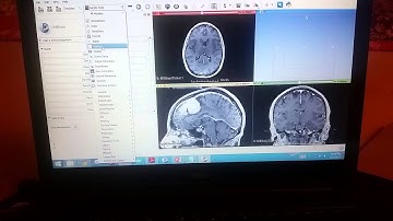 ECE 7400 Assignment 3 Lakshminivasan