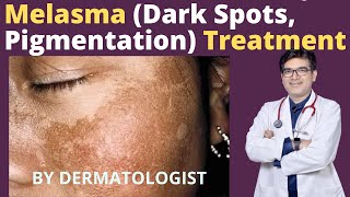 Melasma Treatment | Dark Spots, Pigmentation Treatment | Dr Sunil Kothiwala | Dermatologist