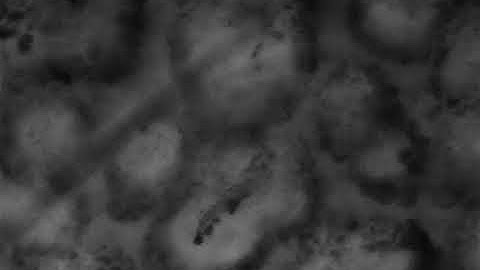 Fluorescence Advanced Videodermoscopy (Using Horus HS 1000 with FAV)