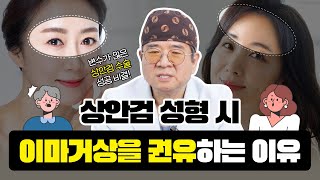 [대전 어울림성형외과] 상안검 성형 시 이마거상 권하는 진짜 이유?