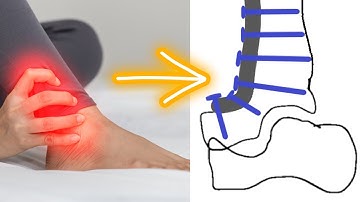 The 4 Ways An Ankle Fusion Can Be Done!