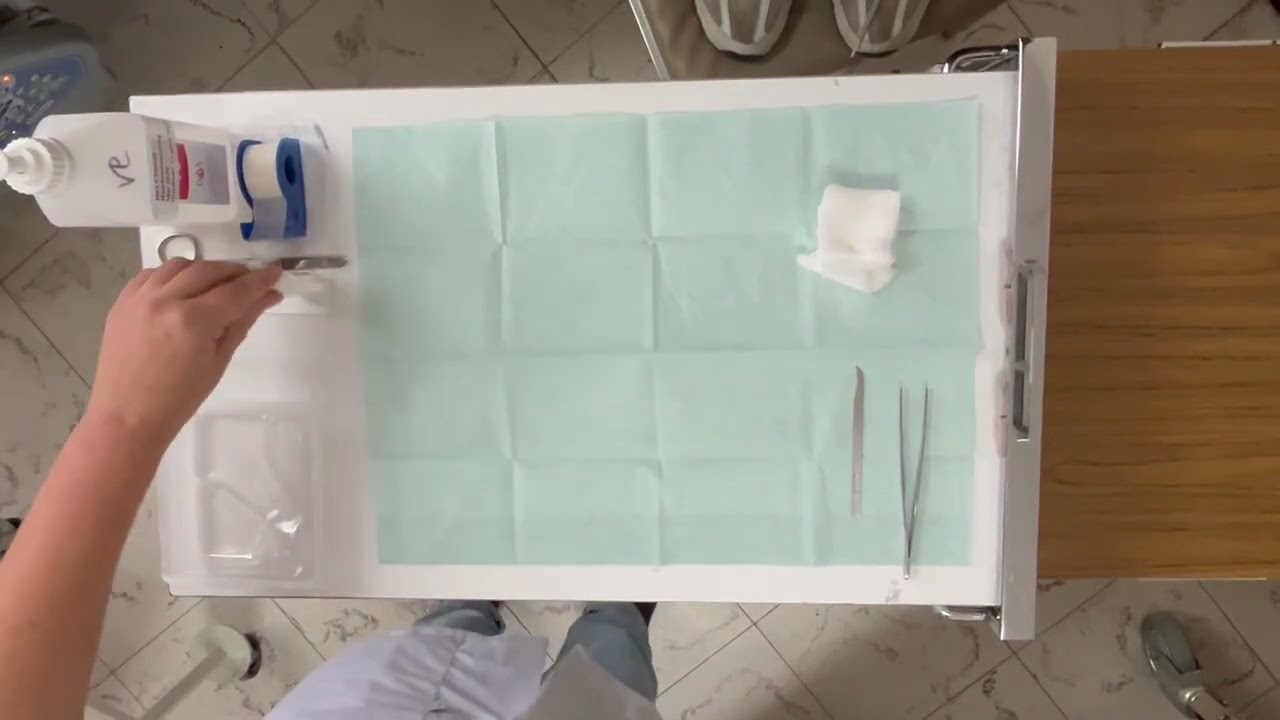 Hechtingen verwijderen