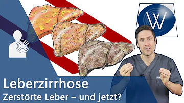 Welche sind die typischen Symptome einer fortgeschrittenen Leberzirrhose?