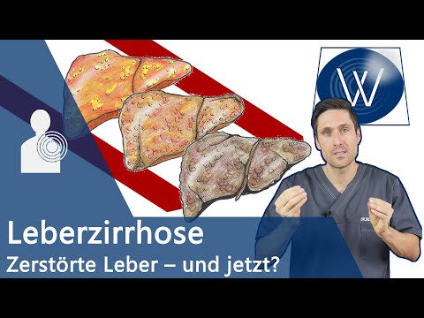 Video: Aszites Bei Leberzirrhose - Wie Lange Leben Sie? Diät Und Behandlung