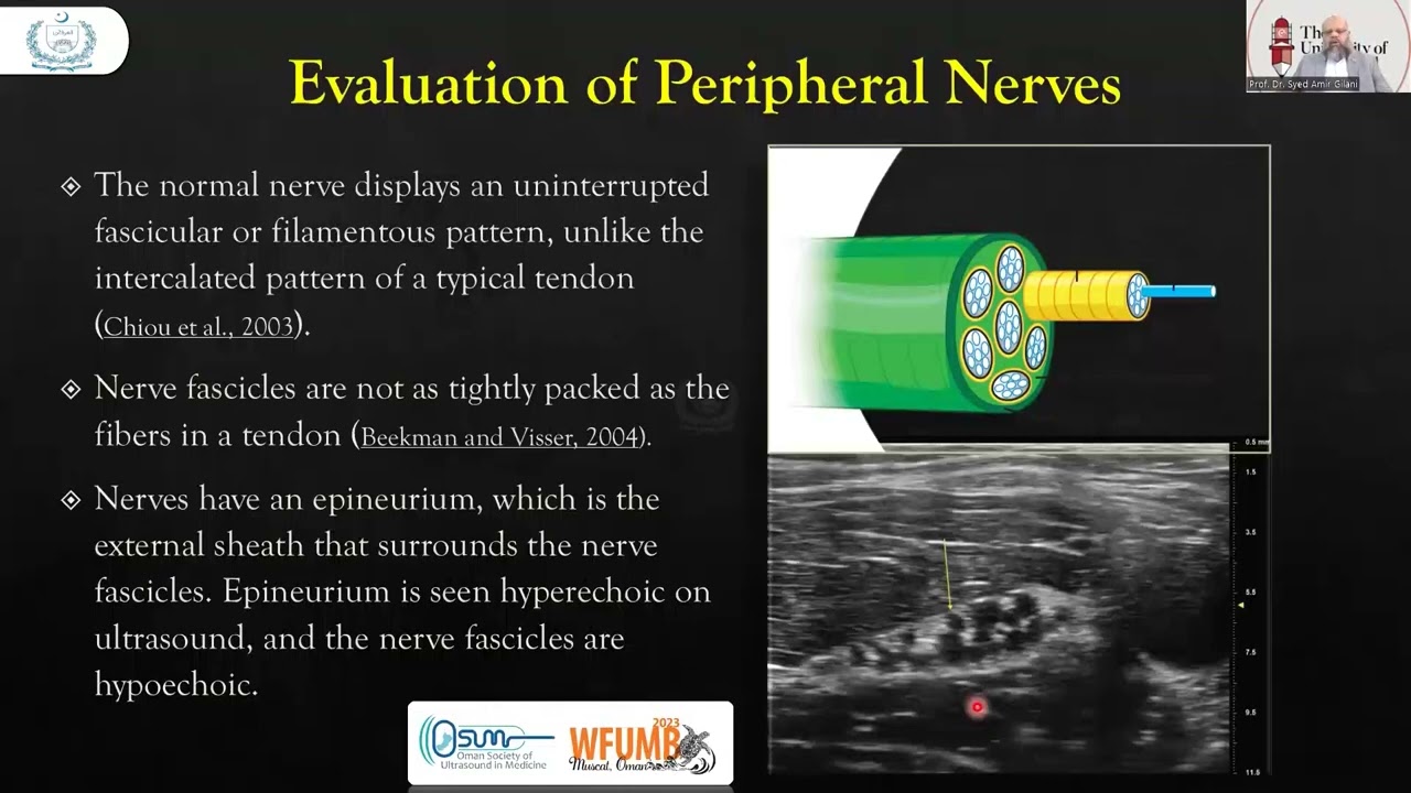 An Overview of Ultrasound of Peripheral Nerves- Webinar