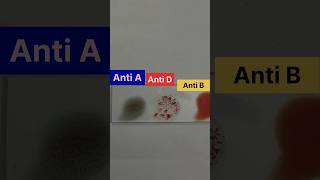 How To Check Blood Group