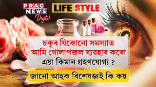 Is it harmful to put rose water in eyes? Are there any side effects? Watch what experts say about it screenshot 2