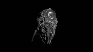 Zebrafish brain neurons Update