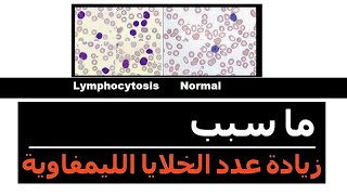 أساب أرتفاع عدد الخلايا الليمفاوية فى تحليل صورة الدم