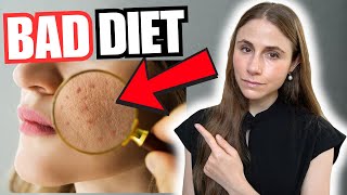 Warning Signs Your Diet Is Hurting Your Skin, Hair & Nails | Dermatologist Explains