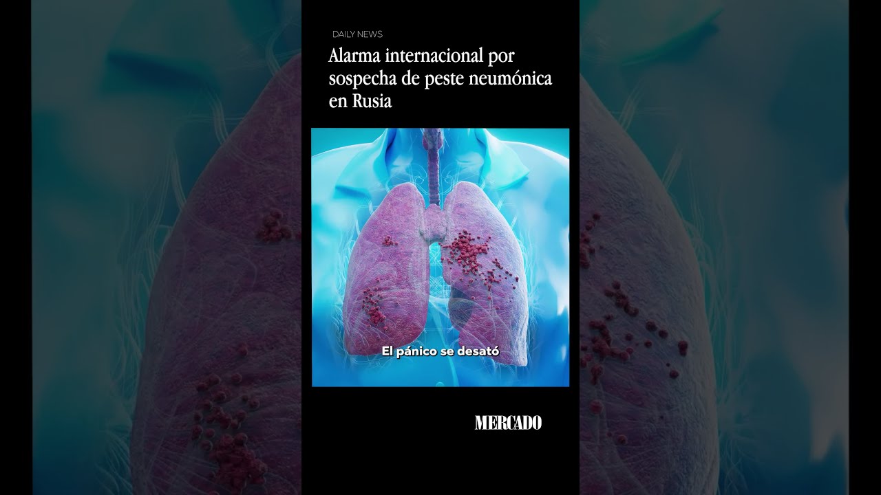 Alarma internacional por sospecha de peste neumónica en Rusia