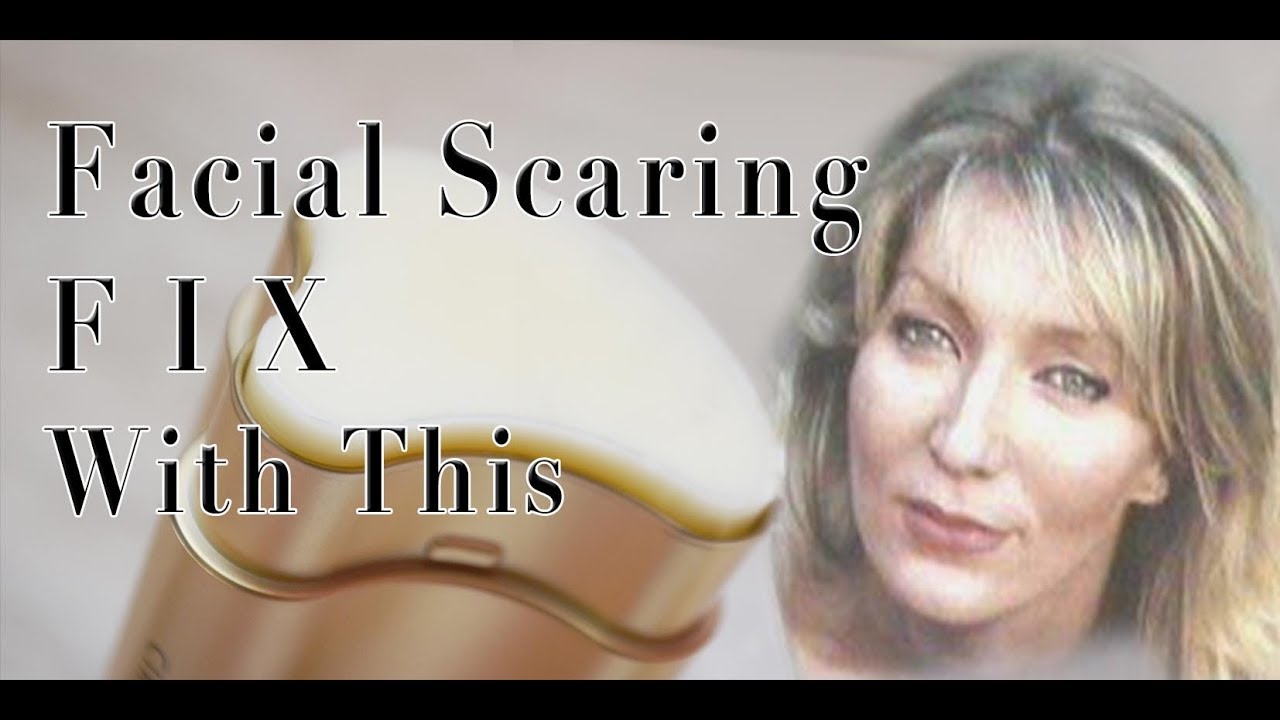 Cirmage Healing Scars & Sun Damage It for real.