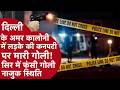 Delhi News - दिल्ली में 17 साल के लड़के के सिर में गोली फंसी, हालत बेहद गंभीर, पुलिस कर रही है जांच